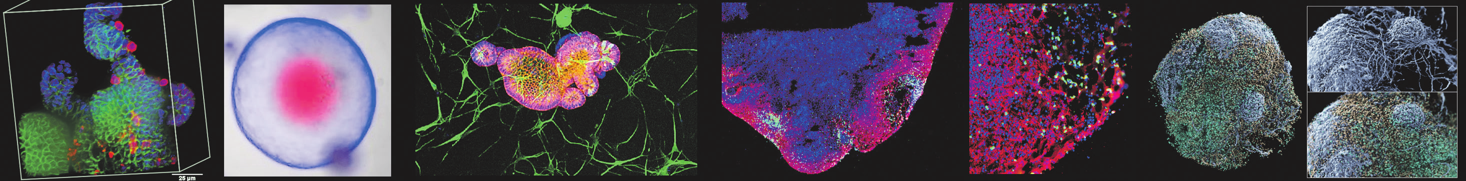 Von der Darm-Gehirn-Achse bis zur digitalen Versorgung: Neue diagnostische und therapeutische Ansätze bei der Parkinson-Krankheit (PK)