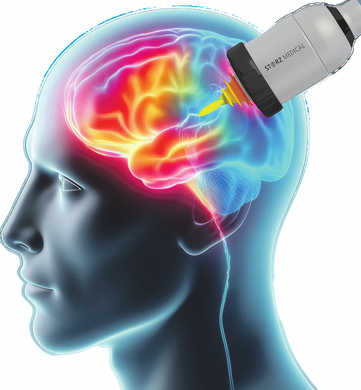 Neustart fürs Gehirn: Wie TPS den Kampf gegen neurodegenerative Krankheiten anführt