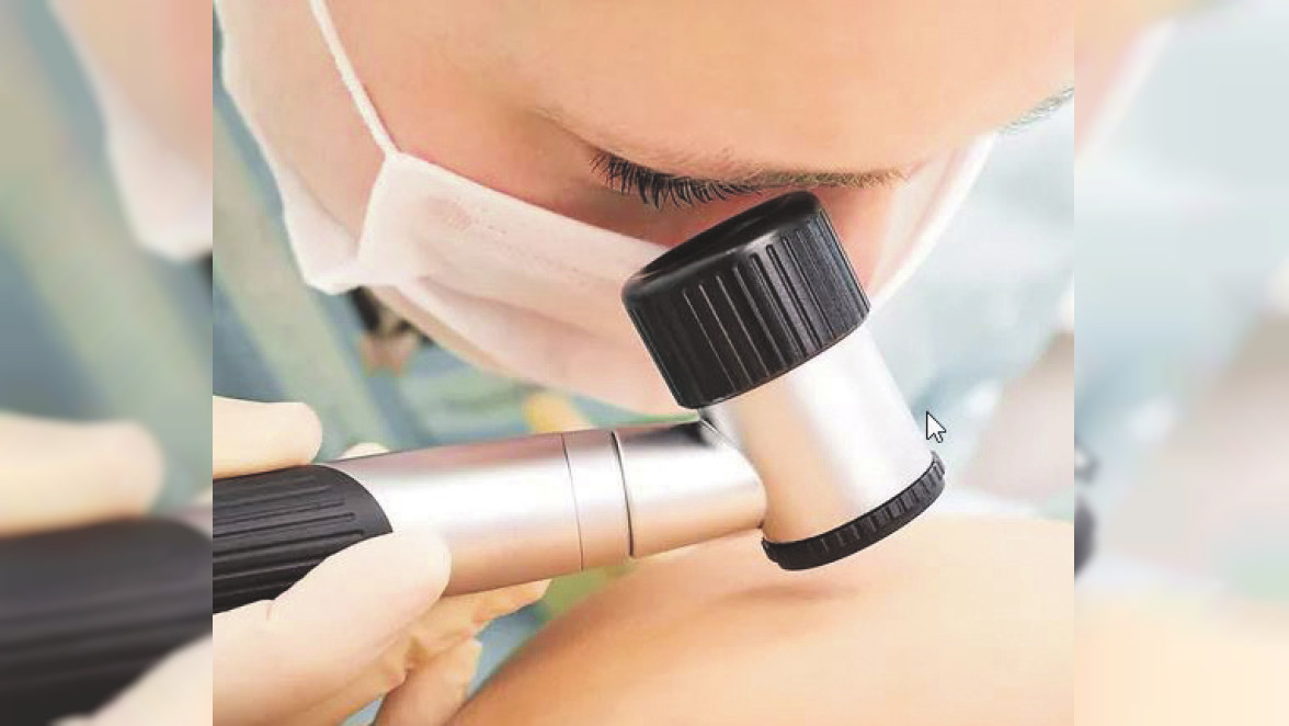 Hautärzte am Marktplatz in Karlsruhe und Mühlacker: Hautkrebs - wenn frühzeitig erkannt, sehr gut heilbar