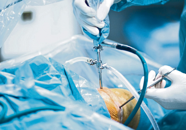 Fachbereich Unfallchirurgie erweitert Leistungsspektrum