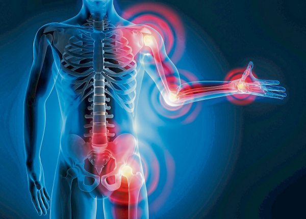 Rheumaeine komplexe Erkrankung