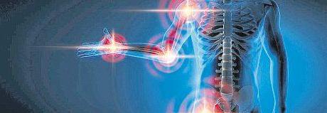 Arthrose und endoprothetischer Gelenkersatz 