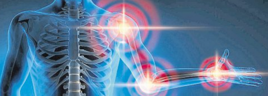 Arthrose ist die weltweit häufigste Gelenkerkrankung