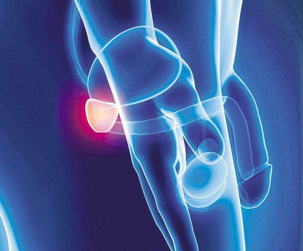 Hochmoderne und schonende Bestrahlung gegen Prostatakrebs