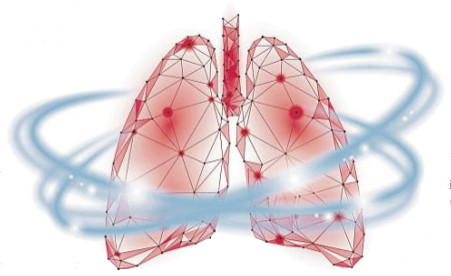 Bronchitis richtig behandeln