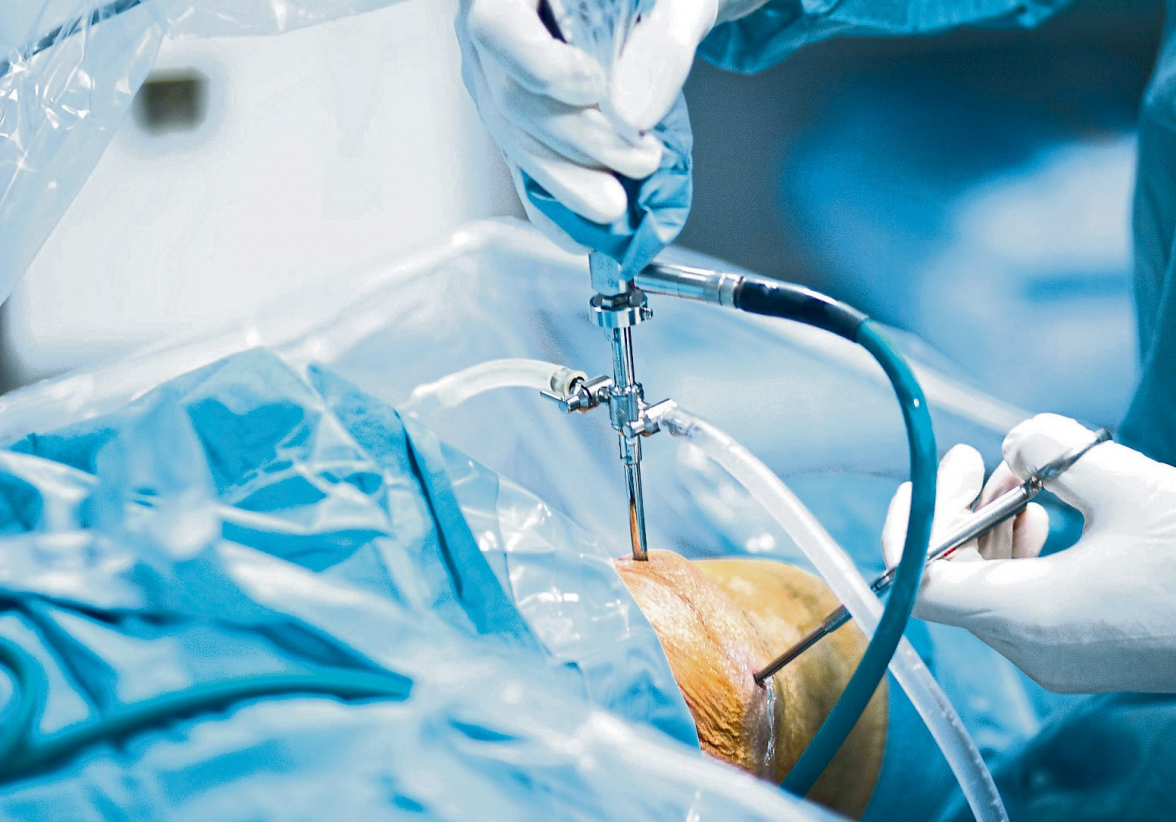 Fachbereich Unfallchirurgie erweitert Leistungsspektrum