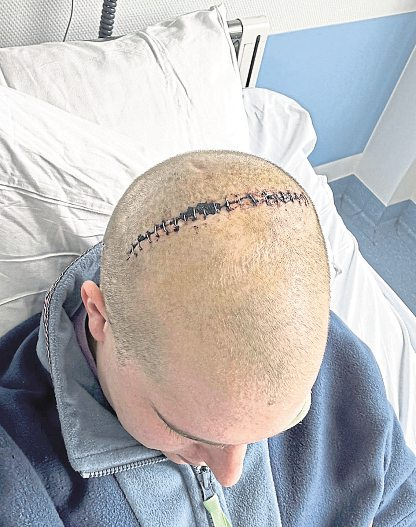 Der Feind in Dennis Dohms Kopf war am Ende stärker